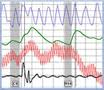 Ventura polygraph at www.VenturaLieDetector.com